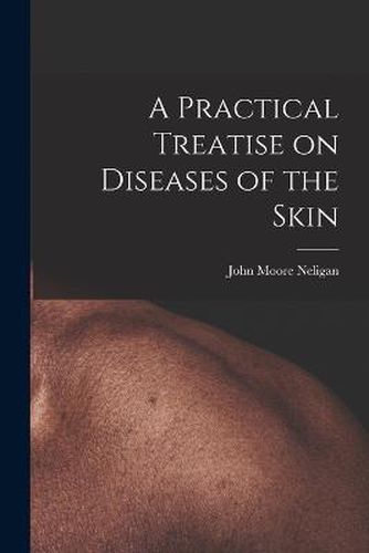 Cover image for A Practical Treatise on Diseases of the Skin