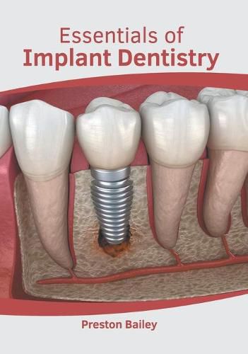 Cover image for Essentials of Implant Dentistry