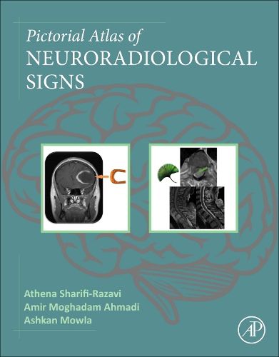 Cover image for Pictorial Atlas of Neuroradiological Signs