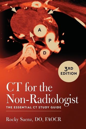 Cover image for Ct for the Non-Radiologist