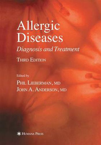 Cover image for Allergic Diseases: Diagnosis and Treatment