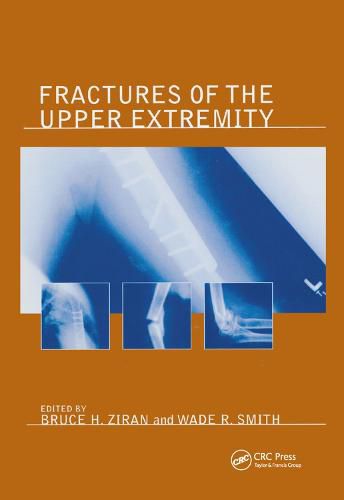 Cover image for Fractures of the Upper Extremity