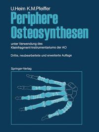 Cover image for Periphere Osteosynthesen: unter Verwendung des Kleinfragment-Instrumentariums der AO