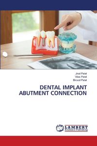 Cover image for Dental Implant Abutment Connection