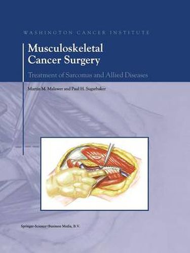 Cover image for Musculoskeletal Cancer Surgery: Treatment of Sarcomas and Allied Diseases