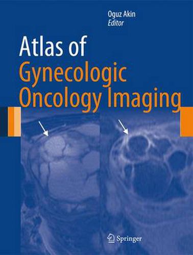 Cover image for Atlas of Gynecologic Oncology Imaging