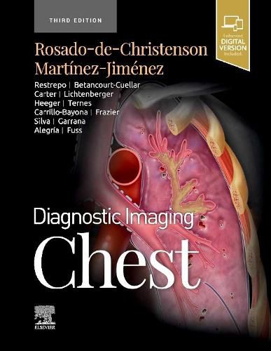 Cover image for Diagnostic Imaging: Chest