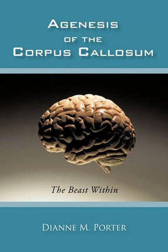 Cover image for Agenesis of the Corpus Callosum
