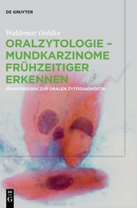 Cover image for Oralzytologie - Mundkarzinome fruhzeitiger erkennen