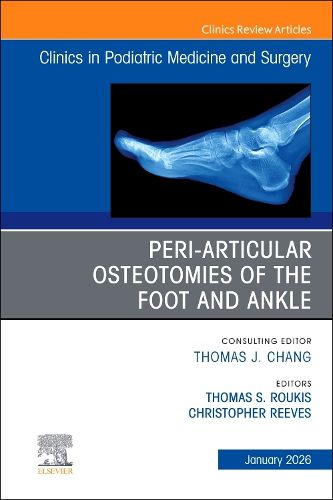 Cover image for Peri-Articular Osteotomies of the Foot and Ankle, An issue of Clinics in Podiatric Medicine and Surgery: Volume 43-1