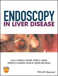 Cover image for Endoscopy in Liver Disease