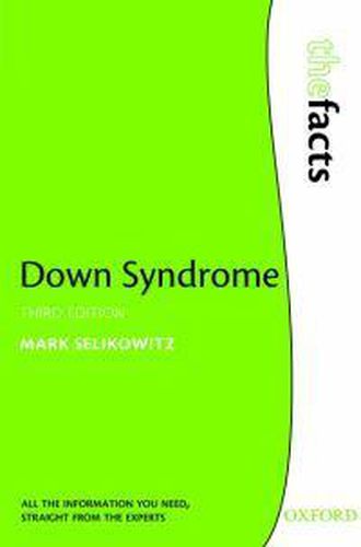 Cover image for Down Syndrome