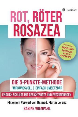 Cover image for Rot Roeter Rosazea