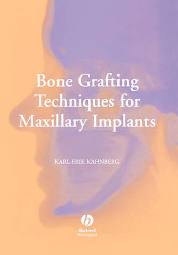 Cover image for Bone Grafting Techniques for Maxillary Implants