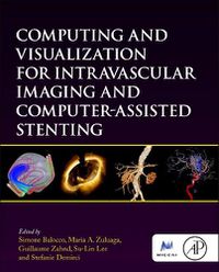 Cover image for Computing and Visualization for Intravascular Imaging and Computer-Assisted Stenting