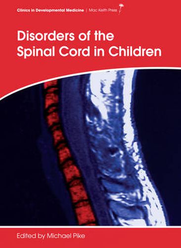 Cover image for Disorders of the Spinal Cord in Children