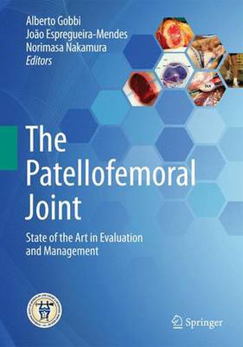 Cover image for The Patellofemoral Joint: State of the Art in Evaluation and Management