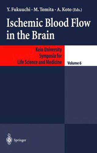 Cover image for Ischemic Blood Flow in the Brain