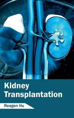 Cover image for Kidney Transplantation