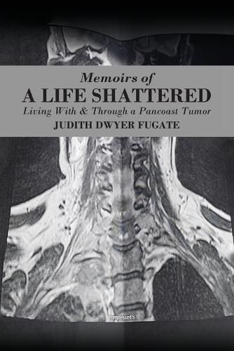 Cover image for Memoirs of a Life Shattered: Living With & Through a Pancoast Tumor