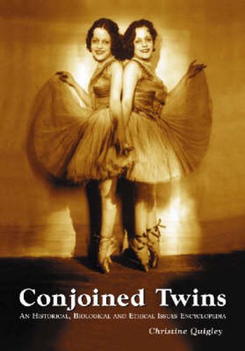 Cover image for Conjoined Twins: An Historical, Biological and Ethical Issues Encyclopedia