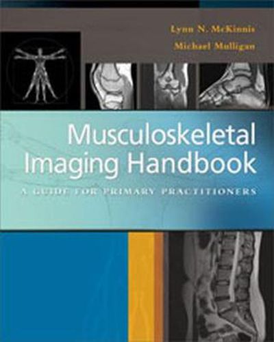 Cover image for Musculoskeletal Imaging Handbook : a Guide for Primary Practitioners