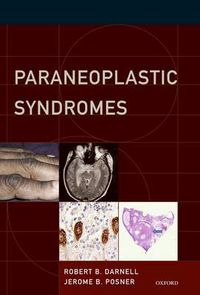 Cover image for Paraneoplastic Syndromes