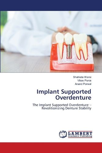 Cover image for Implant Supported Overdenture