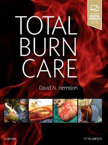 Cover image for Total Burn Care