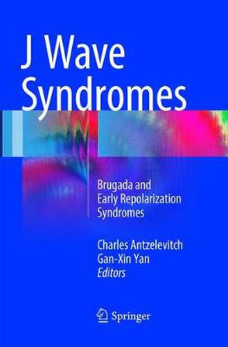 Cover image for J Wave Syndromes: Brugada and Early Repolarization Syndromes