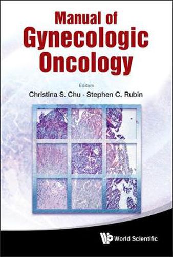 Cover image for Manual Of Gynecologic Oncology