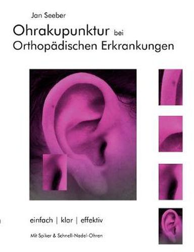Cover image for Ohrakupunktur bei Orthopadischen Erkrankungen: Balancierte Ohrakupunktur: einfach, klar, effektiv