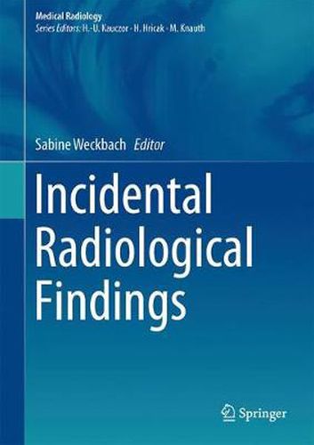 Cover image for Incidental Radiological Findings