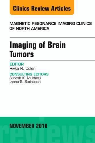 Cover image for Imaging of Brain Tumors, An Issue of Magnetic Resonance Imaging Clinics of North America