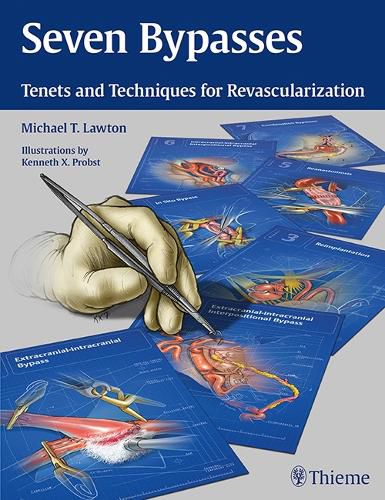 Cover image for Seven Bypasses: Tenets and Techniques for Revascularization