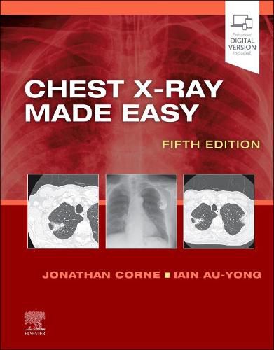 Cover image for Chest X-Ray Made Easy