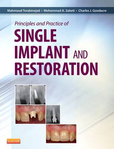 Cover image for Principles and Practice of Single Implant and Restoration