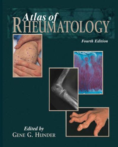Cover image for Atlas of Rheumatology