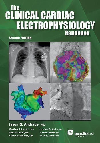 The Clinical Cardiac Electrophysiology Handbook, Second Edition