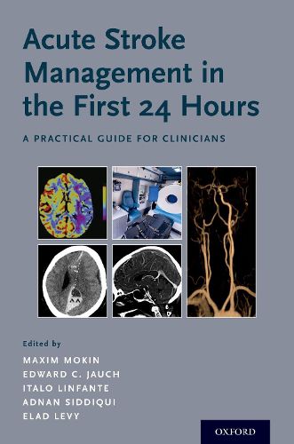 Cover image for Acute Stroke Management in the First 24 Hours: A Practical Guide for Clinicians