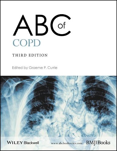 Cover image for ABC of COPD, 3e