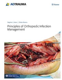 Cover image for Principles of Orthopedic Infection Management