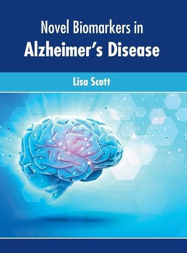 Cover image for Novel Biomarkers in Alzheimer's Disease