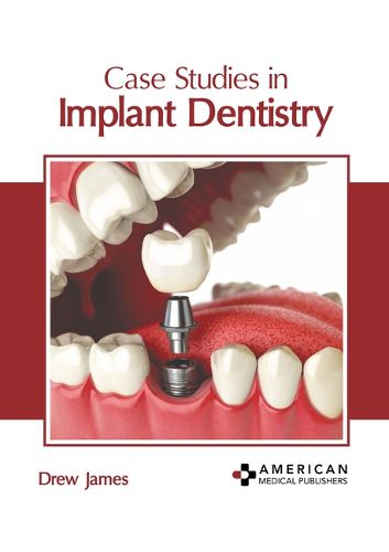 Cover image for Case Studies in Implant Dentistry