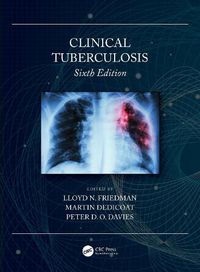 Cover image for Clinical Tuberculosis