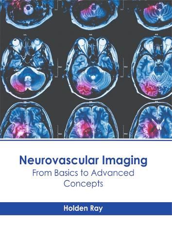 Cover image for Neurovascular Imaging: From Basics to Advanced Concepts