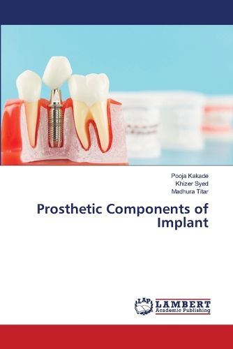 Cover image for Prosthetic Components of Implant