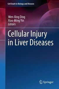 Cover image for Cellular Injury in Liver Diseases