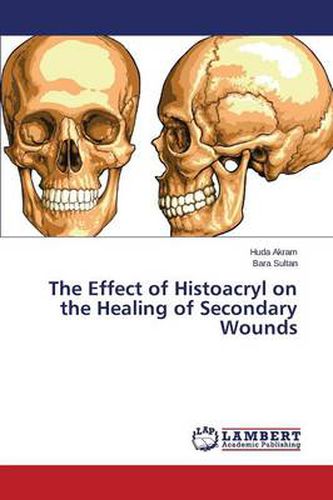 Cover image for The Effect of Histoacryl on the Healing of Secondary Wounds