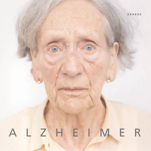 Cover image for Alzheimer